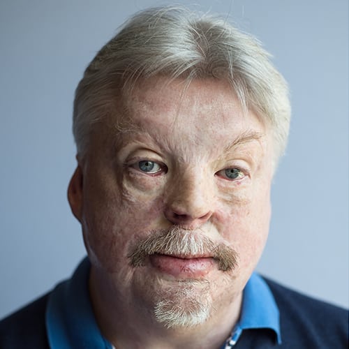 Simon Weston CBE
